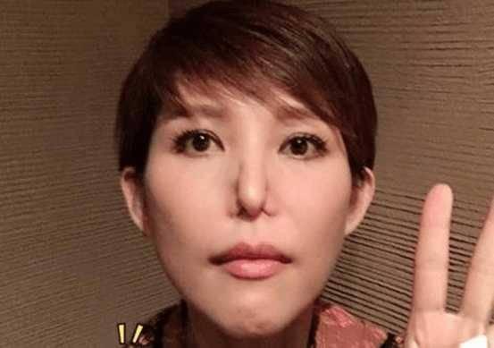 明星有没有耳蜗,明星们的耳蜗生成揭秘